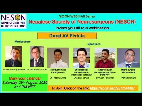 dural Arteriovenous fistula or dAVF