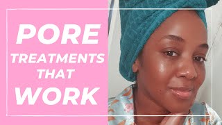 Treatment for Large Pores that WORK! (Black Skin)