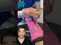 Cast coming off for a wrist break