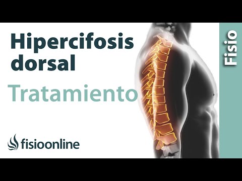 Unguento dalle articolazioni della spalla Mal di schiena tra le scapole il forum
