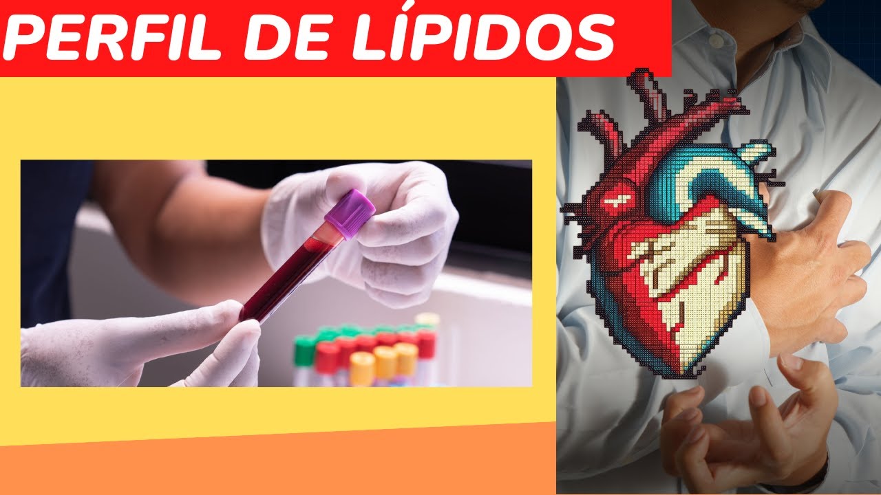 ¿Qué es el perfil lipídico? LIB ASK