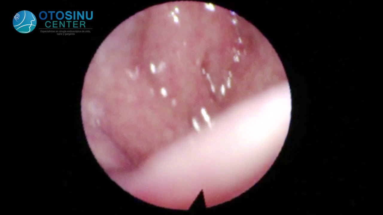 Walter Florez Guerra-16