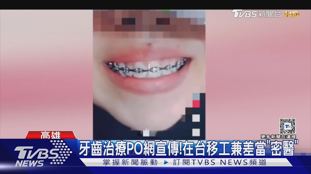 看影片自學牙齒矯正！印尼籍移工當非法「地下牙醫」