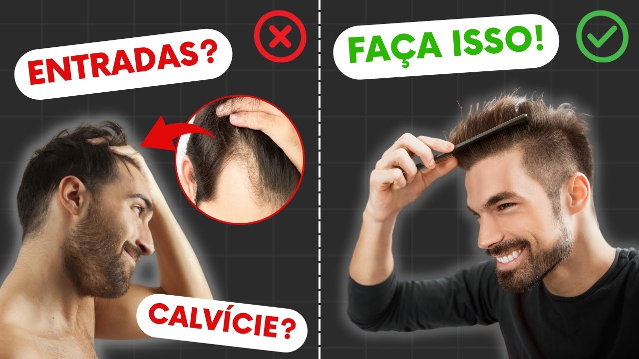 Visagismo masculino: Como disfarçar entradas no cabelo