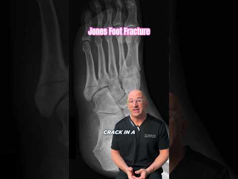 Tiny Fracture, Huge Consequences #shorts