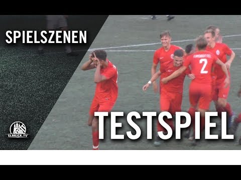 Eimsbütteler TV U19 – SC Condor (Testspiel)