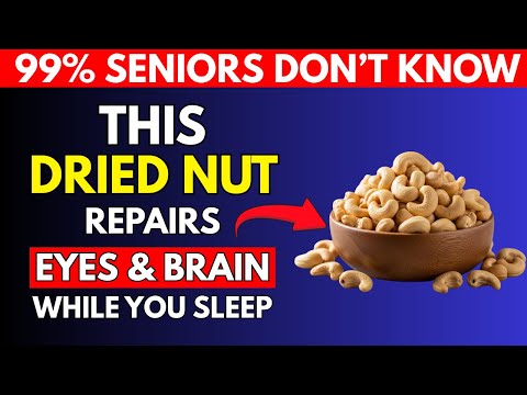 Seniors: Health Benefits of Eating Cashew Nuts – 7 Powerful Eye & Brain Health Benefits After 50