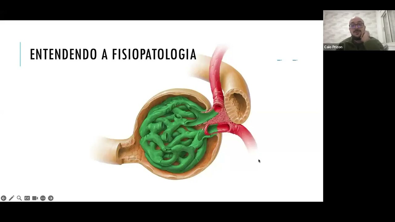 Lesão Renal Aguda (LRA) - Aula Dr  Caio Prizon