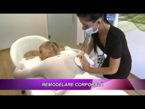 INTRE FETE   REMODELARE CORPORALA