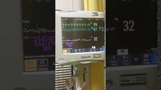 Download lagu MESIN PENGUKUR DETAK JANTUNG mp3