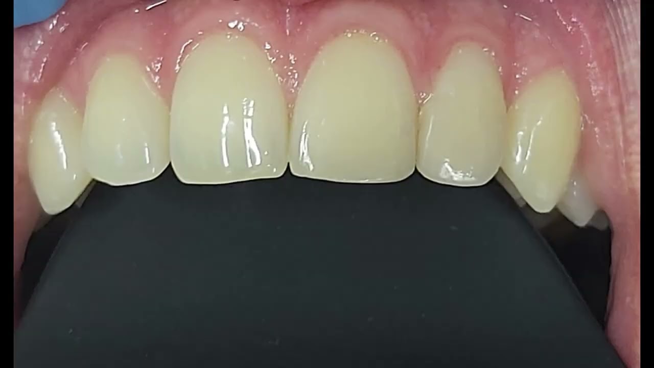 Rafał Wróblewski-11