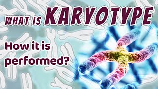 What is Karyotype and How it is Performed