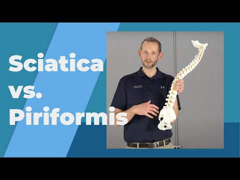 True Sciatica VS Piriformis Syndrome