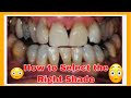 SHINY SMILE Veneers | How to Select the BEST Shade