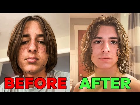 Looksmaxxing is getting out of hand…