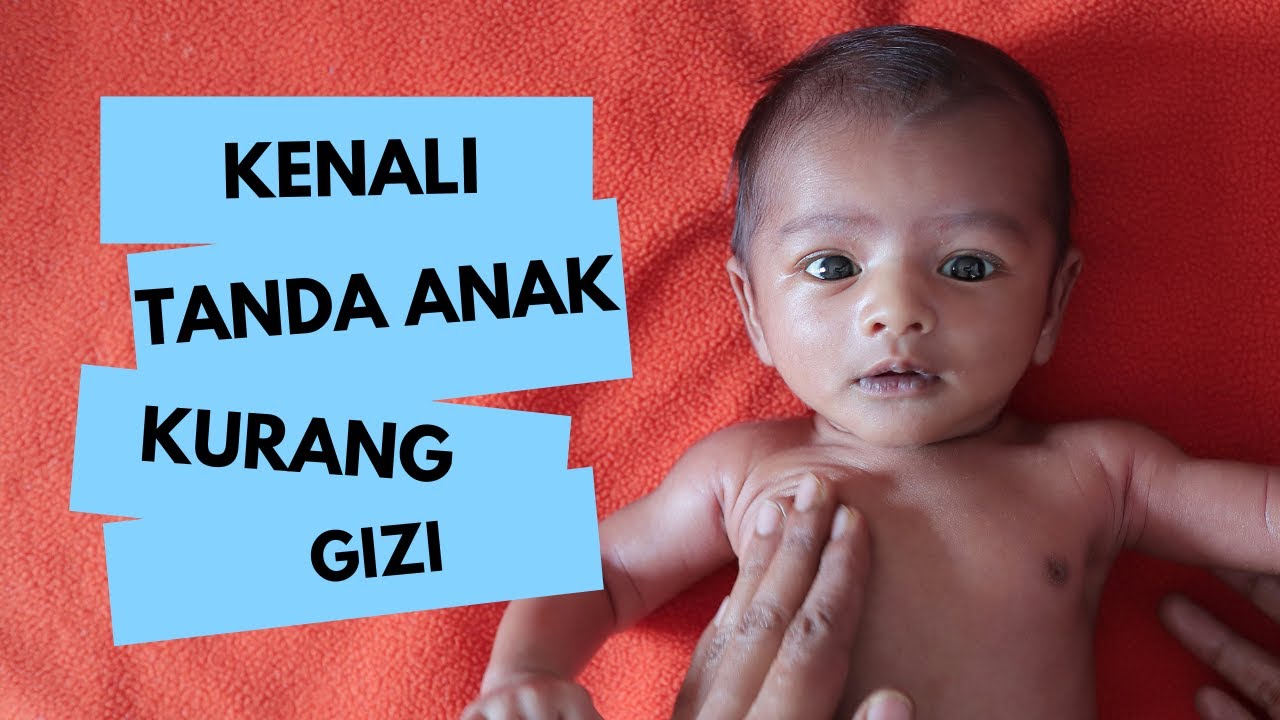 Kurang Gizi pada Anak, Kenali Tanda, Penyebab, hingga Cara Mencegahnya #malnutrition #giziburuk
