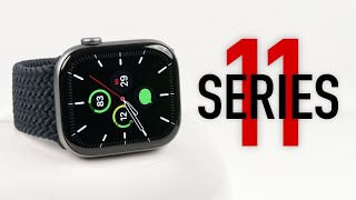 Apple Watch Series 11 - REVIEW | Was hat sich wirklich verändert?