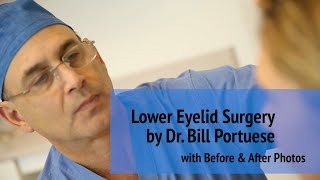 👁️ Lower Eyelid Surgery to Remove Bags Under The Eyes - How It Works