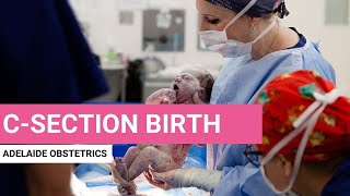 C-sections: Giving birth by cesarean section