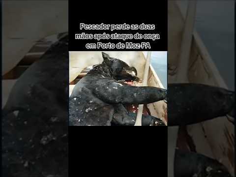 Pescador perde as duas mãos após ataque de onça em Porto de Moz-PA