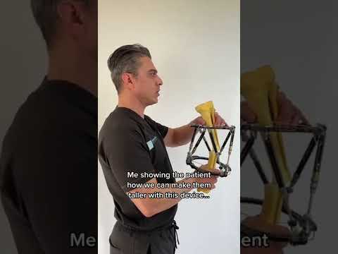 Work of art limb lengthening device