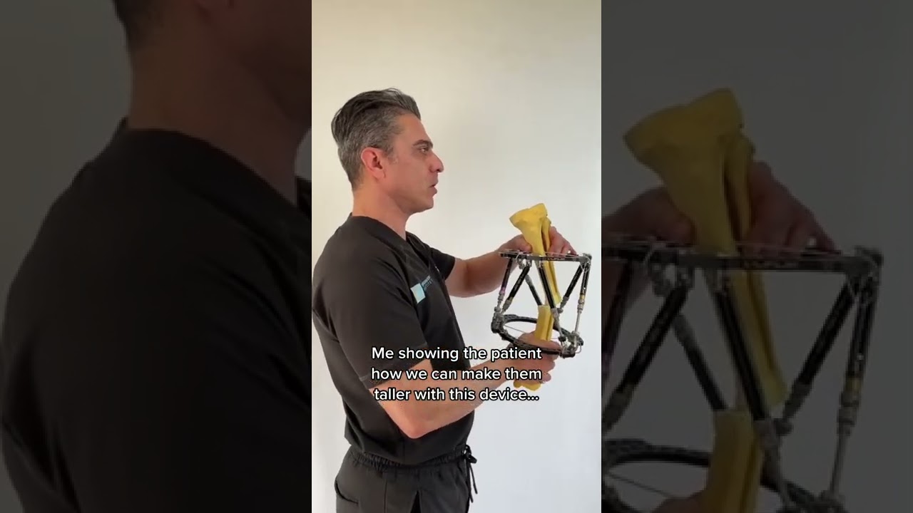 Work of art limb lengthening device