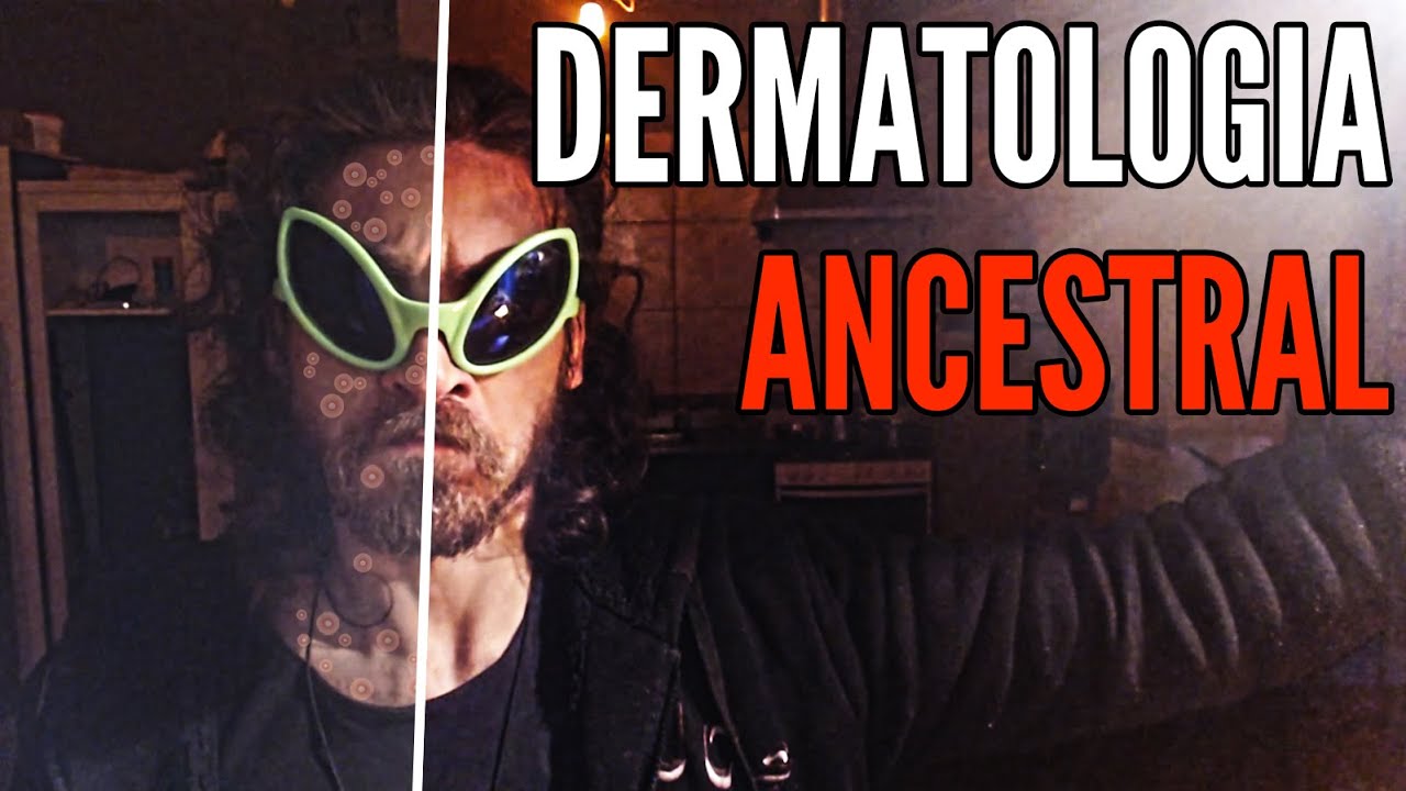 Acne NÃO É NATURAL - Como se livrar de espinhas e inflamações de pele PRA SEMPRE [Live Tétrade #25]