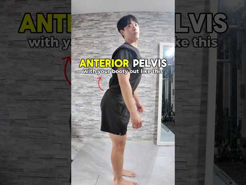 4 STEPS Finally Fix Anterior Pelvic Tilt Posture