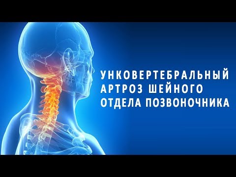 Болят суставы лечение лекарствами и народными средствами Лфк при остеохондрозе коленного сустава