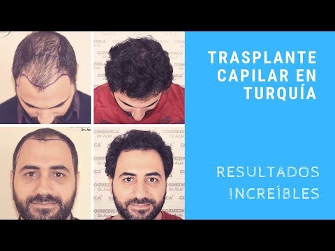 download lagu mp3 mp4 Microfue, download lagu Microfue gratis, unduh video klip Microfue