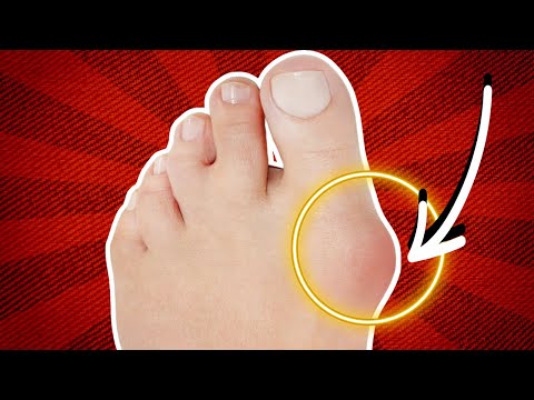 What Type of Shoes Are Best for Foot Health