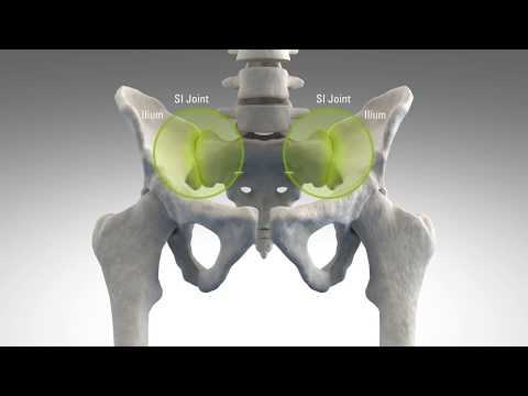 The SI Joint: An Overlooked Cause of Low Back Pain - Dr. Lorio