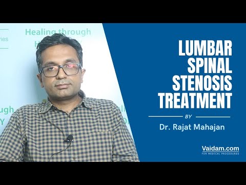 Lumbar Spinal Stenosis Treatment in India | Best explained by Dr. Rajat Mahajan