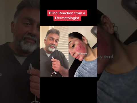 Реакция на Аккутан от дерматолога #шорты