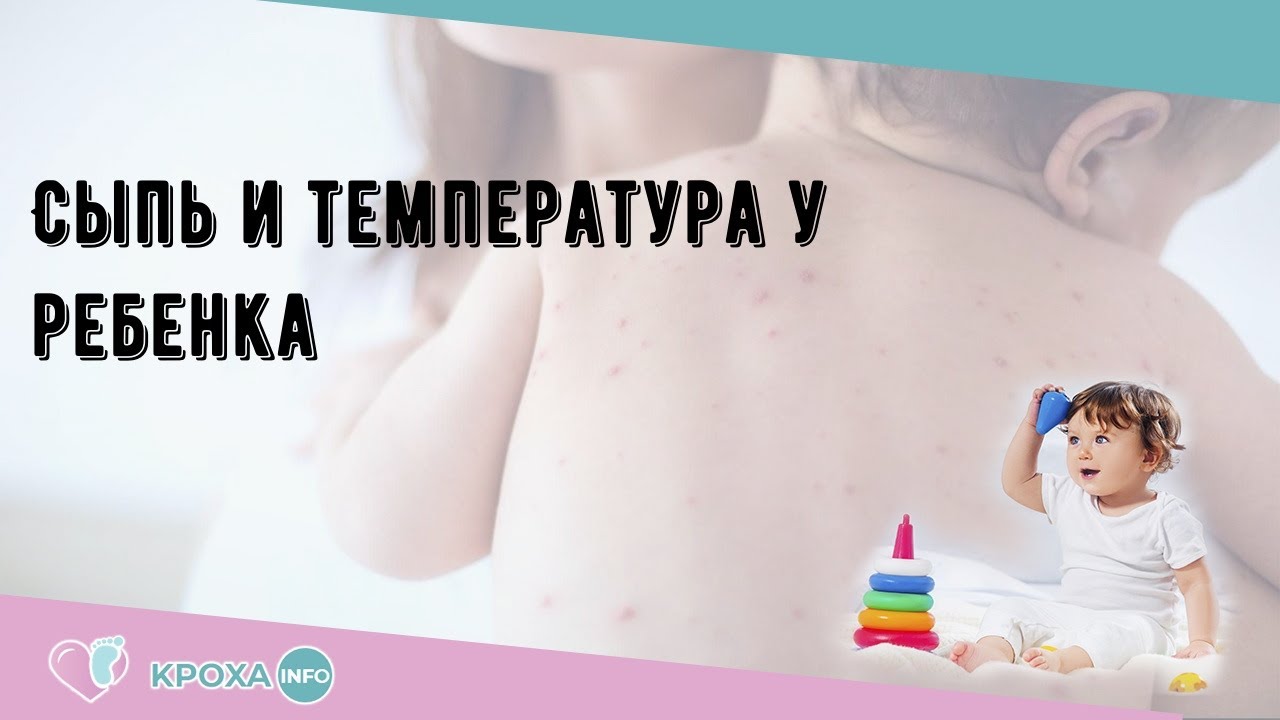 Сыпь и температура у ребенка