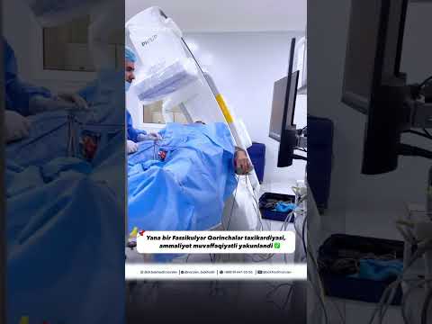 Aritmiya Murojat uchun: +998 91 447-33-55 #doctor #arrhythmia #taxi #yurak #RCHA