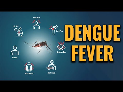 Dengue fever - Symptoms and causes