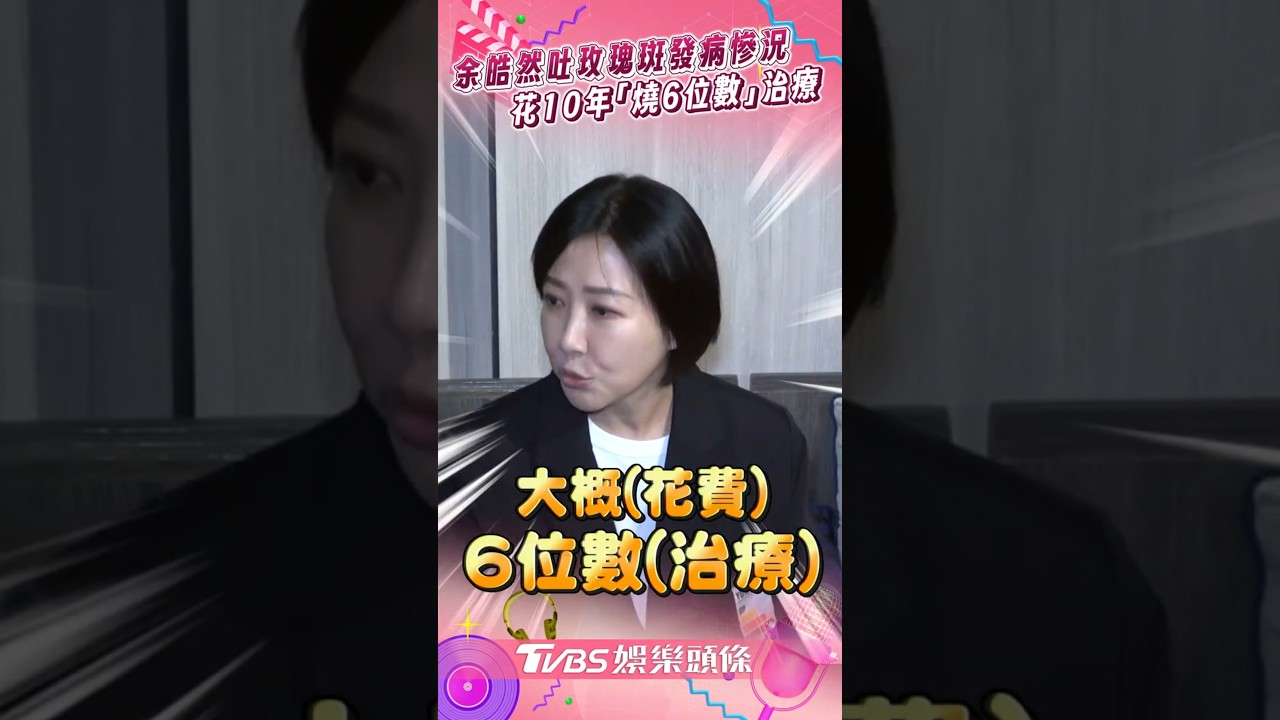 影音/余皓然吐昔玫瑰斑發病慘況 花費10年「狂燒6位數」治療