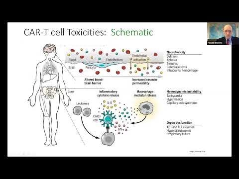 CAR T-CELL Therapy in DLBCL, When and Which? - Dr. Michael Williams (Sep 30-Oct 1, 2022)