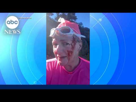 Woman needs 38 stitches after otter attack