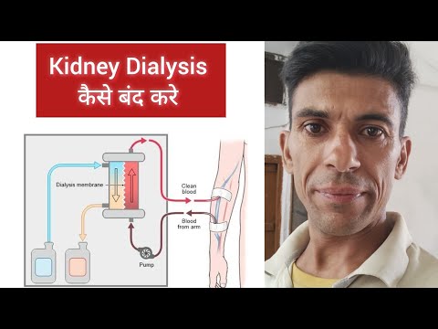 How to Stop Kidney Dialysis - By Dr. Vinod Kumar