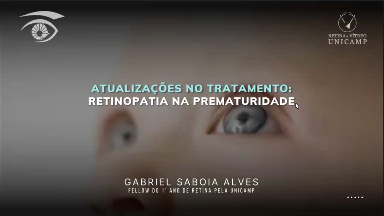 Retina e Vítreo (10/10/2024) - Atualizações no Tratamento: Retinopatia na Prematuridade