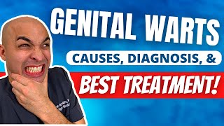 Genital Warts Explained | [ Symptoms, Diagnosis, and Treatment ]