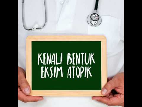 Kenali Bentuk Eksim Atopik