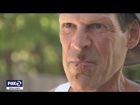 Ultramarathon Runner Posts Video Right After Being Attacked By Coyote While Running