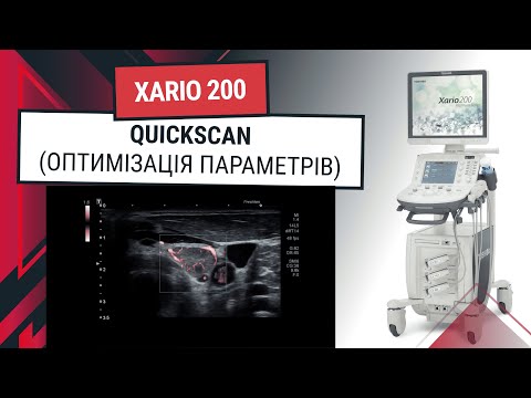 Як покращити зображення на УЗД апарат Toshiba (Canon) Xario 200? - Статті RH