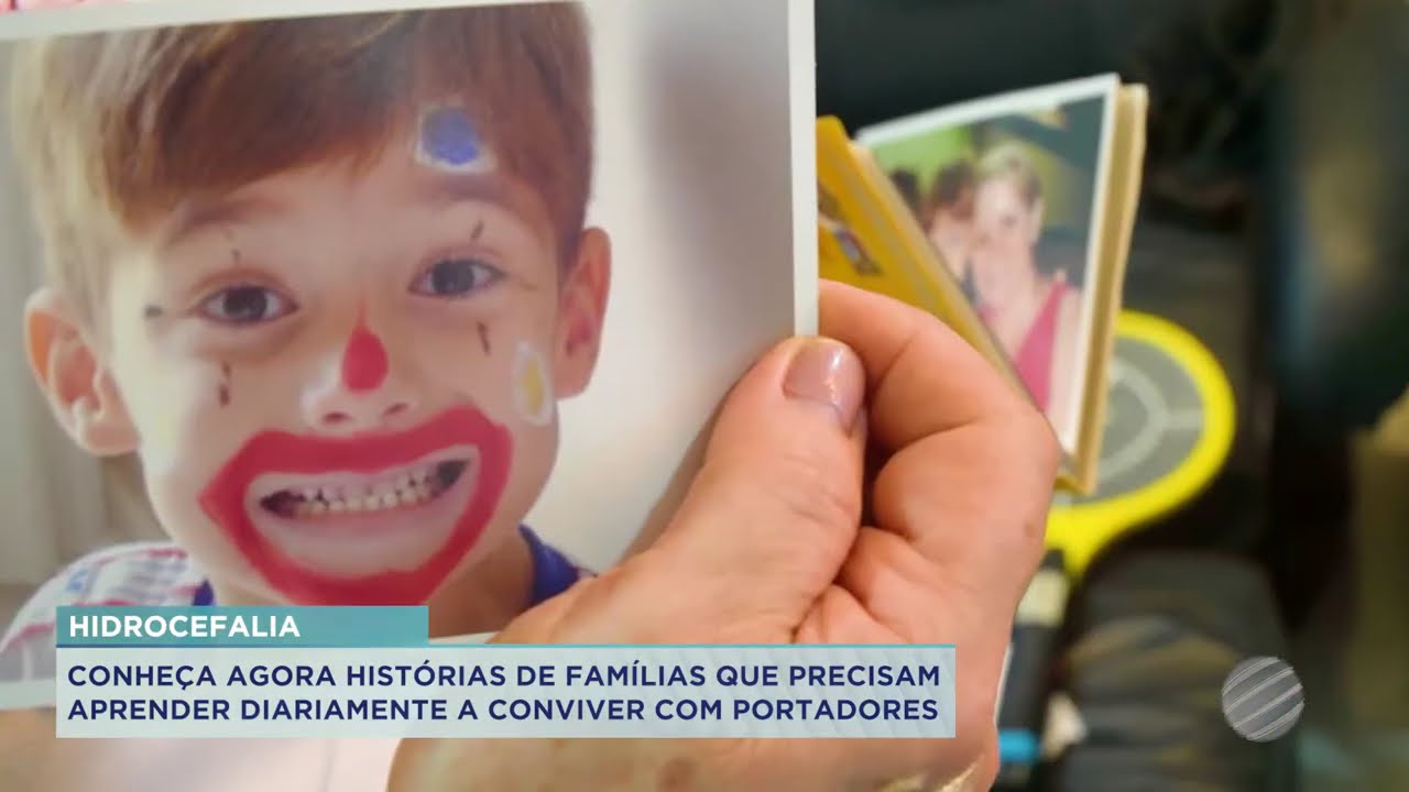 CONHEÇA AGORA HISTÓRIAS DE FAMÍLIAS QUE PRECISAM APRENDER DIARIAMENTE A CONVIVER COM PORTADORES
