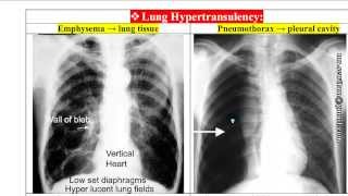 Dr.Mahmoud Sewilam, Chest X-Rays