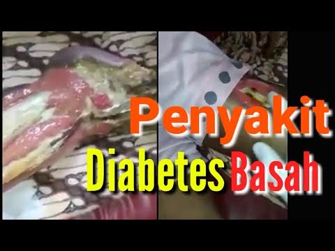 Zucker schädlich für Diabetiker Ob gelegt Behinderung bei Patienten mit Diabetes mellitus Typ 2