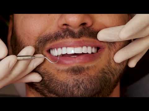 Resultado Paciente Lente Express em Porcelana